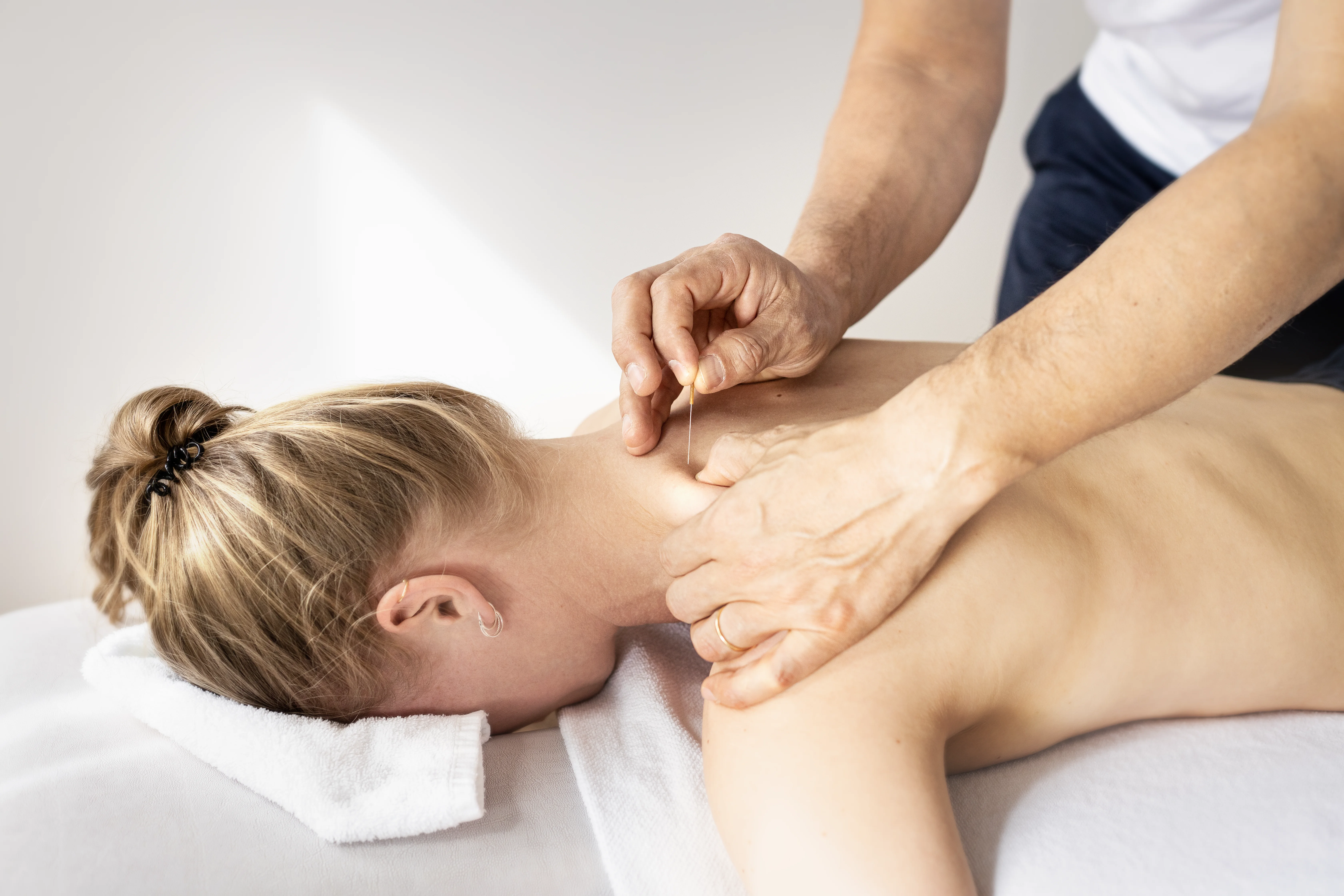 Physiotherapeut führt Triggerpunkttherapie/Dry needling an Patientin durch